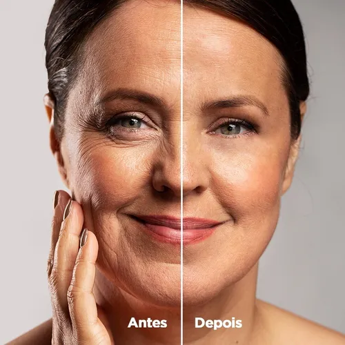Antes-x-Depois-Rosa-Mosqueta-1