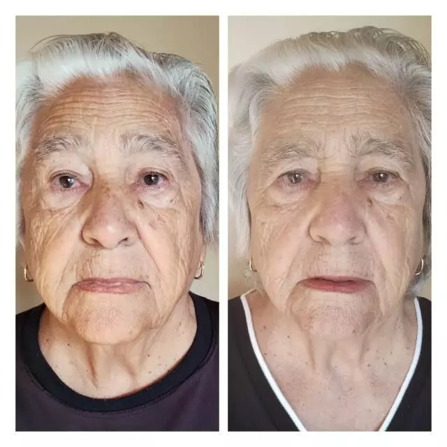 Antes-x-Depois-Rosa-Mosqueta-2